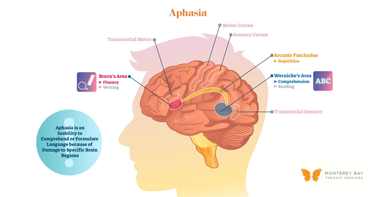 Diagram of What is Aphasia | Monterey Bay Therapy Services | Speech & Occupational Therapy Across California