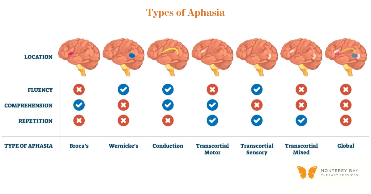Diagram of Types of Aphasia | Monterey Bay Therapy Services | Speech & Occupational Therapy Across California