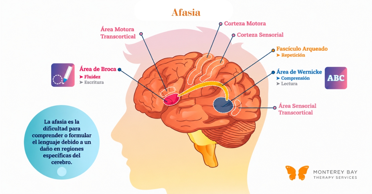 Diagrama de qu&eacute; es la afasia | Monterey Bay Therapy Services | Terapia del habla y terapia ocupacional en toda California