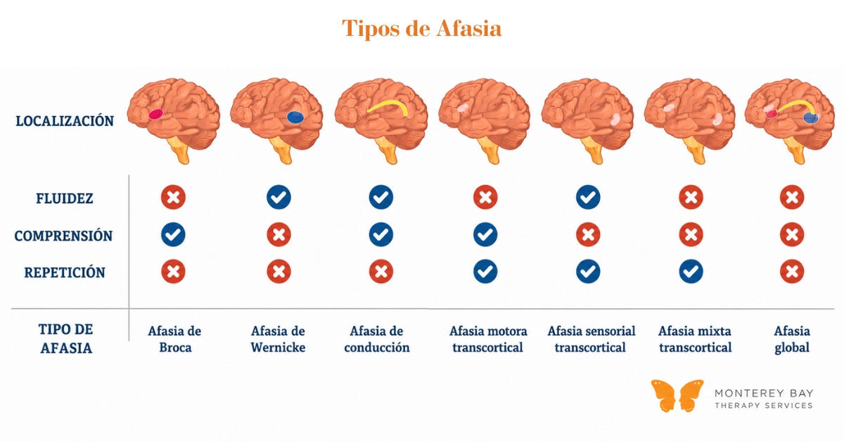 Diagrama de los tipos de afasia | Monterey Bay Therapy Services | Terapia del habla y terapia ocupacional en toda California